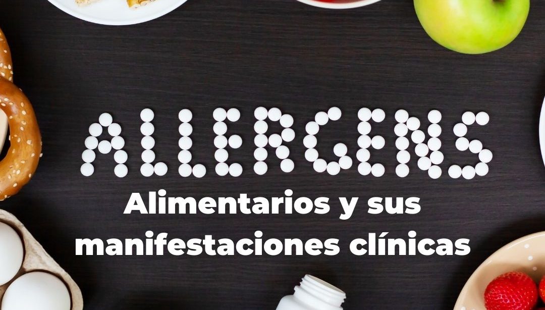 Alérgenos alimentarios y sus manifestaciones clínicas, nutricionista, nutricionista clínica