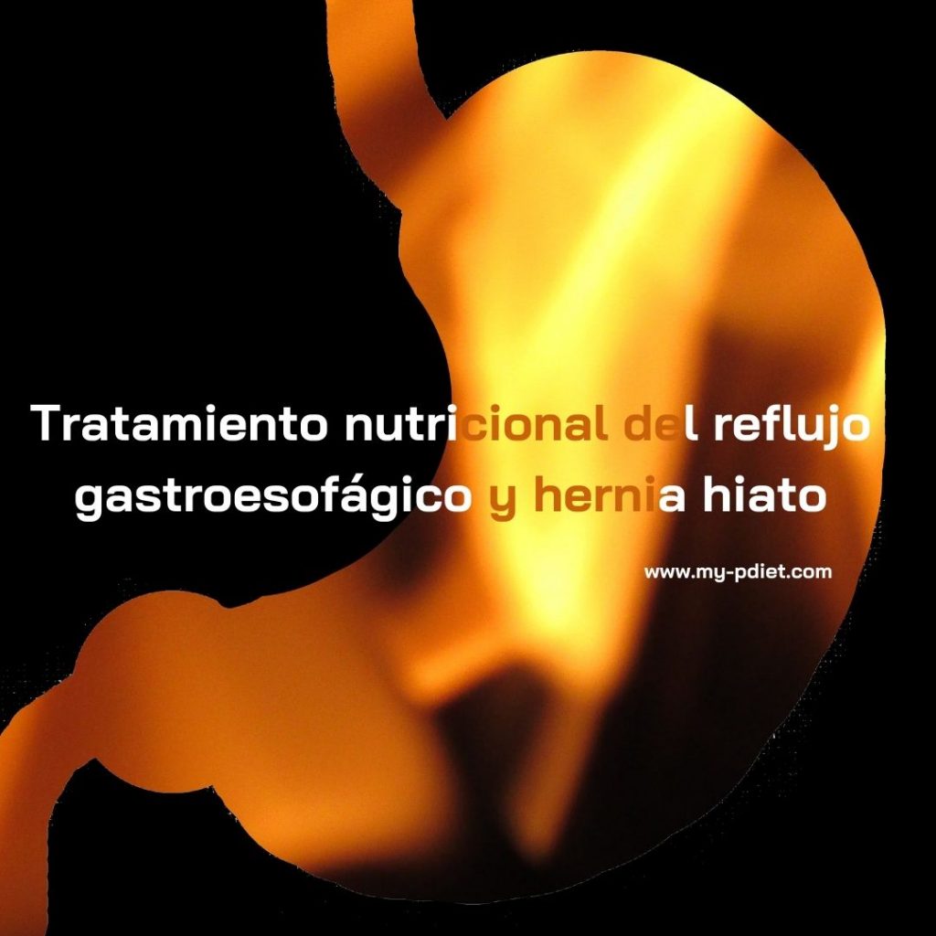 Tratamiento Nutricional Del Reflujo Gastroesofágico Y Hernia Hiato