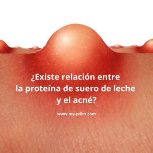 Existe relación entre la proteína de suero de leche y el acné? -   - Nutrición