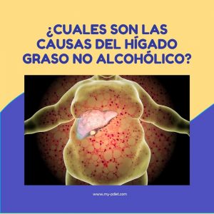 ¿Cuales son las causas del hígado graso no alcohólico?, nutricionista, nutricionista clínica