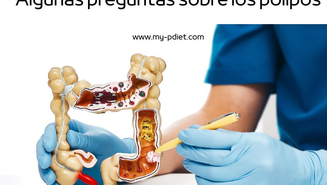 Algunas preguntas sobre los pólipos, nutricionista, nutricionista clínica