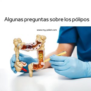 Algunas preguntas sobre los pólipos, nutricionista, nutricionista clínica