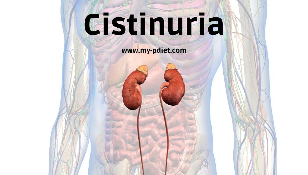 Cistinuria, nutricionista, nutricionista clínica