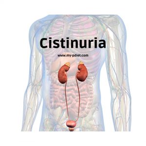 Cistinuria, nutricionista, nutricionista clínica