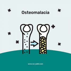 Osteomalacia, nutricionista, nutricionista clínica