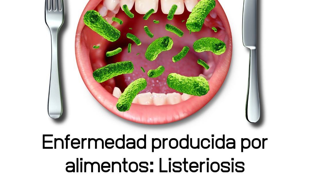 Enfermedad producida por alimentos: Listeriosis, nutricionista, nutricionista clínica