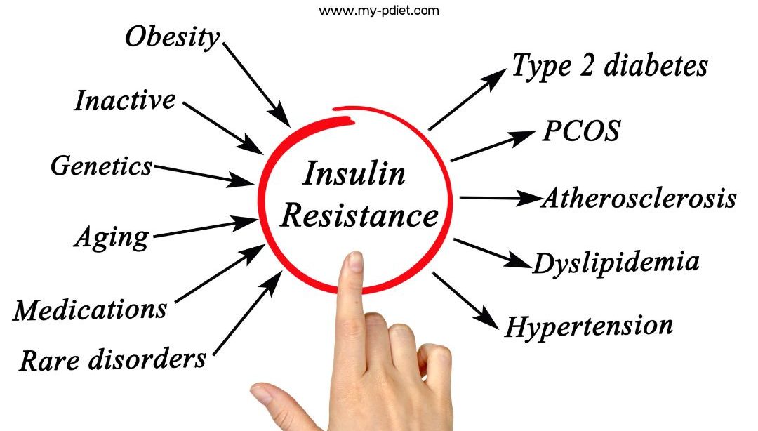 Hiperinsulinemia, nutricionista, nutricionista clínica