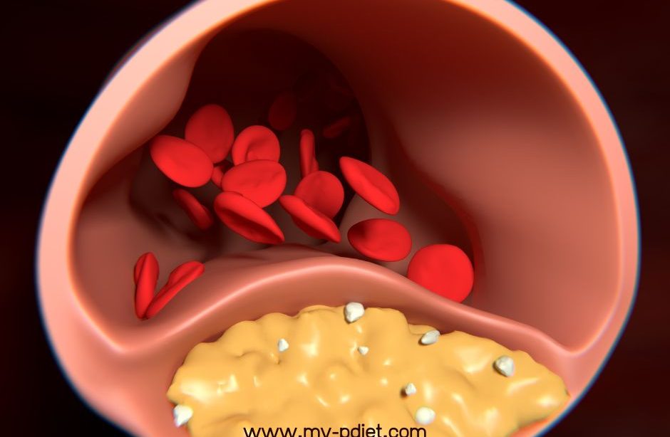 Colesterol y sistema Inmunitario, nutricionista, nutricionista clínica