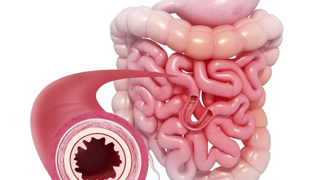 Alimentación y enfermedad intestinal inflamatoria: Una relación crucial., nutricionista clínica, nutricionista